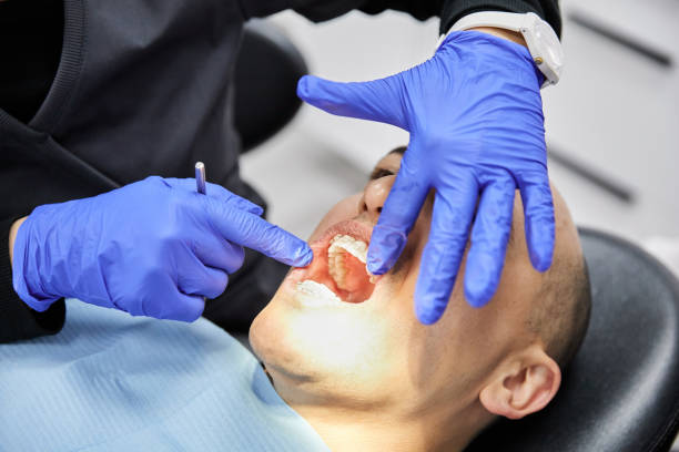 Best Emergency Dental Care for Broken or Chipped Teeth in Eagle Point, AL